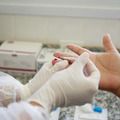 Ministério da Saúde realiza oficina sobre eliminação da Aids e do HIV no Piauí